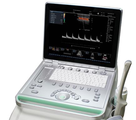 C5笔记本款便携彩超彩色多普勒超声诊断系统