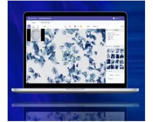 宫颈细胞图像分析处理软件
